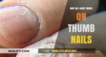 Understanding Thumbnail Tidges: Causes, Concerns, and Effective Solutions Explained