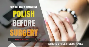 Surgery Prep: Why Nail Polish Must Go