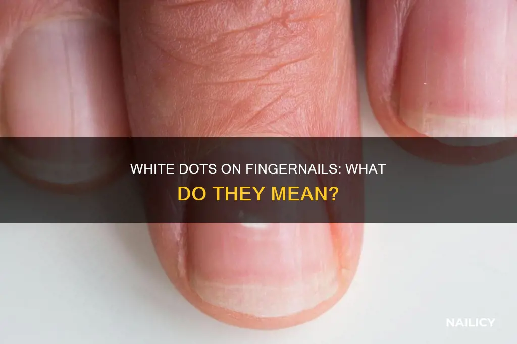 why do i have white dots on my finger nails