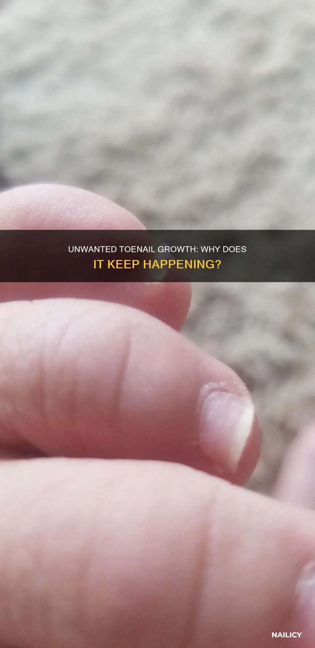 why do i keep growing new toe nails