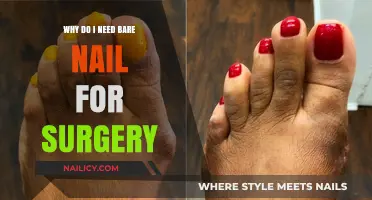 Bare Nails for Surgery: Essential Precautions and Patient Safety Tips