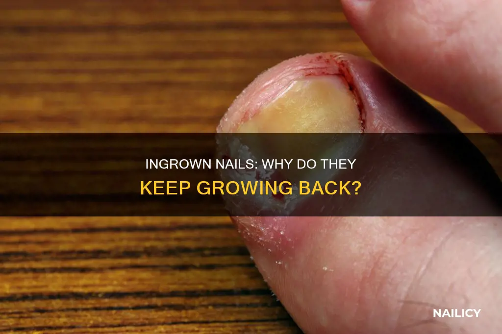 why do ingrown nails grow back