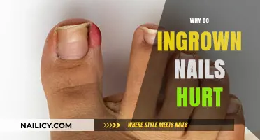 Why Ingrown Nails Cause Pain: Understanding the Uncomfortable Truth