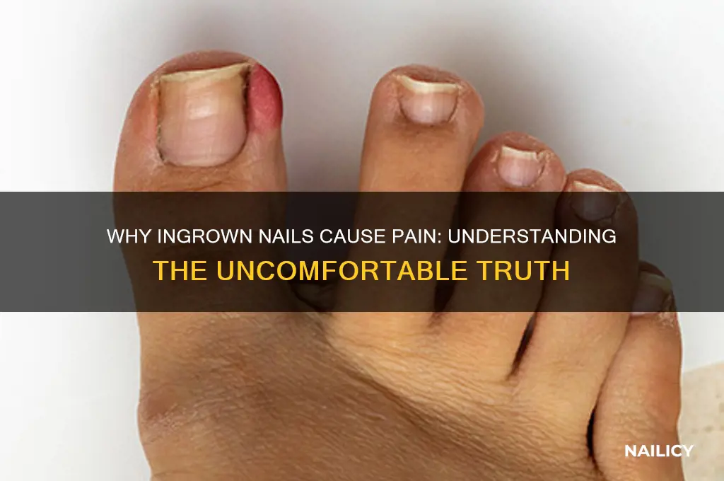 why do ingrown nails hurt
