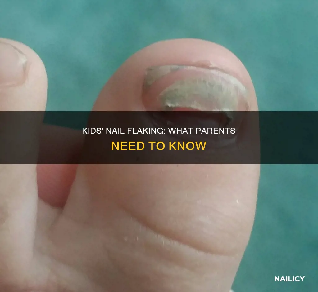 why do kids finger nails flake
