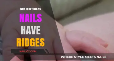 Understanding Baby Nail Ridges: Causes and When to Seek Advice