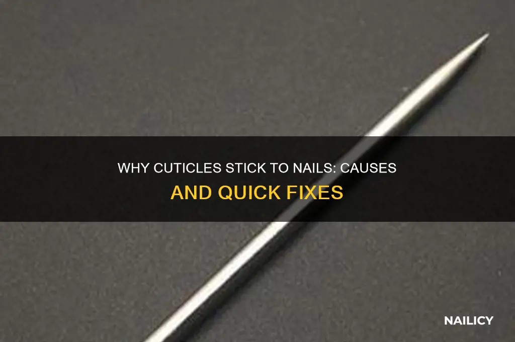 why do my cuticles stick to my nails