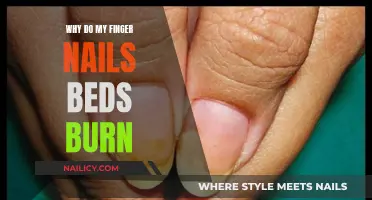 Fingernail Bed Burns: Understanding the Painful Mystery