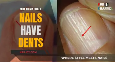 Unraveling the Mystery: Why Do My Finger Nails Have Dents?