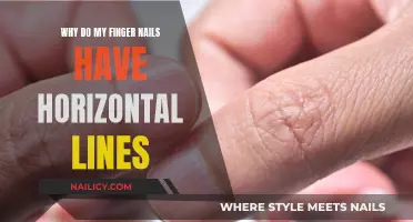 Unraveling the Mystery: Horizontal Lines on Your Fingernails