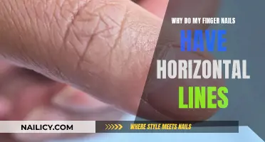 Horizontal Lines on Fingernails: What Do They Mean?