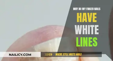 White Lines on Nails: What Does It Mean?