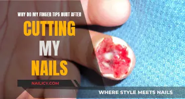 Nail Trim Pain: Why Your Tips Hurt