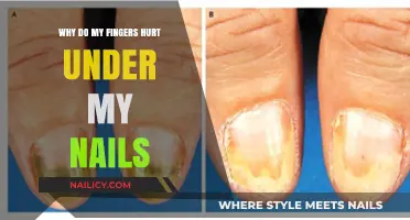 Why Do My Fingers Hurt Under My Nails? Causes and Remedies