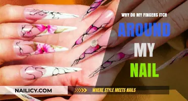 Itchy Fingers Near Nails? Causes and Remedies Explained