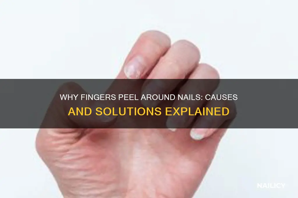 why do my fingers peel around my nails