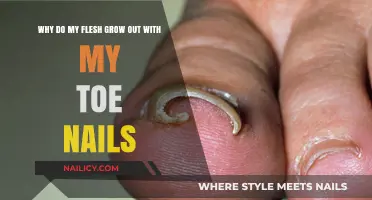 Flesh Growing with Toe Nails: What's Happening?