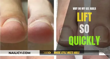 Gel Nails: Why They Lift and How to Prevent It