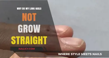 Long Nails, Short Story: Why They Don't Grow Straight