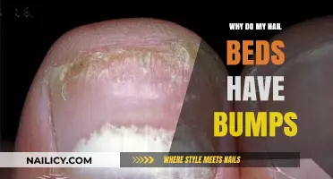 Bumpy Nail Beds: Causes, Concerns, and Solutions Explained