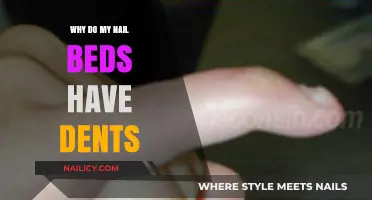 Dented Nail Beds: Causes, Concerns, and When to Seek Help