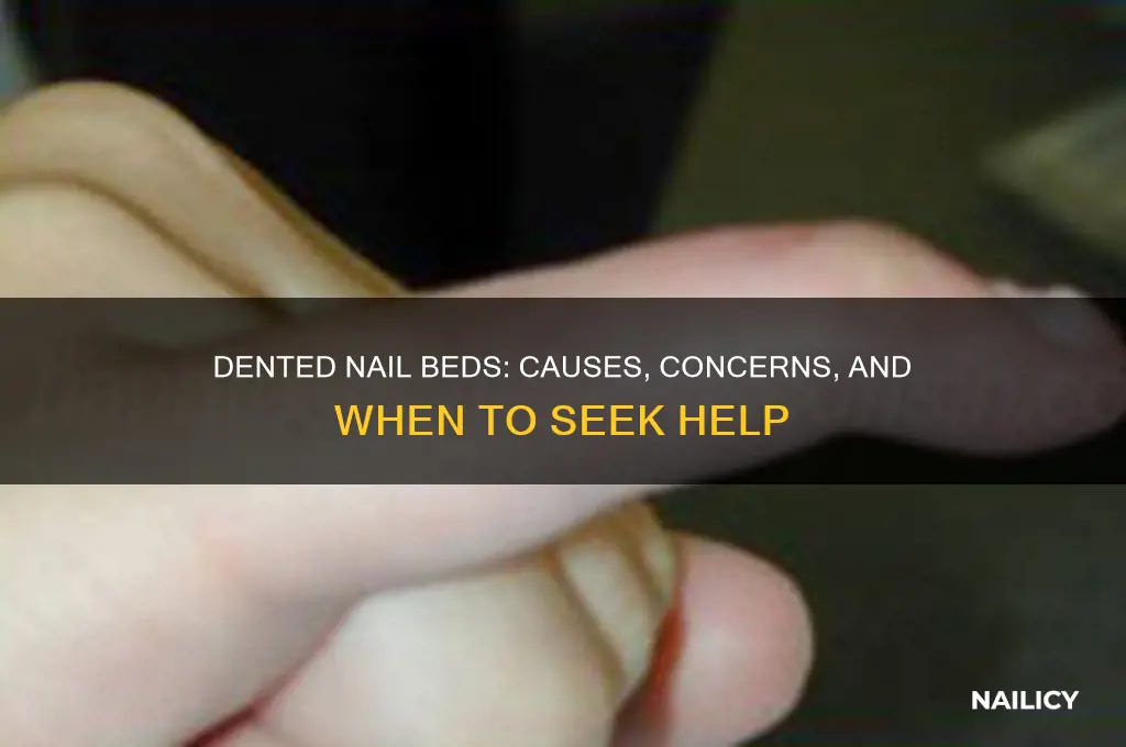 why do my nail beds have dents
