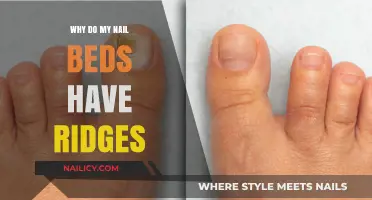 Why Do My Nail Beds Have Ridges? Causes and Solutions