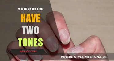 Why Do My Nail Beds Have Two Tones? Causes Explained