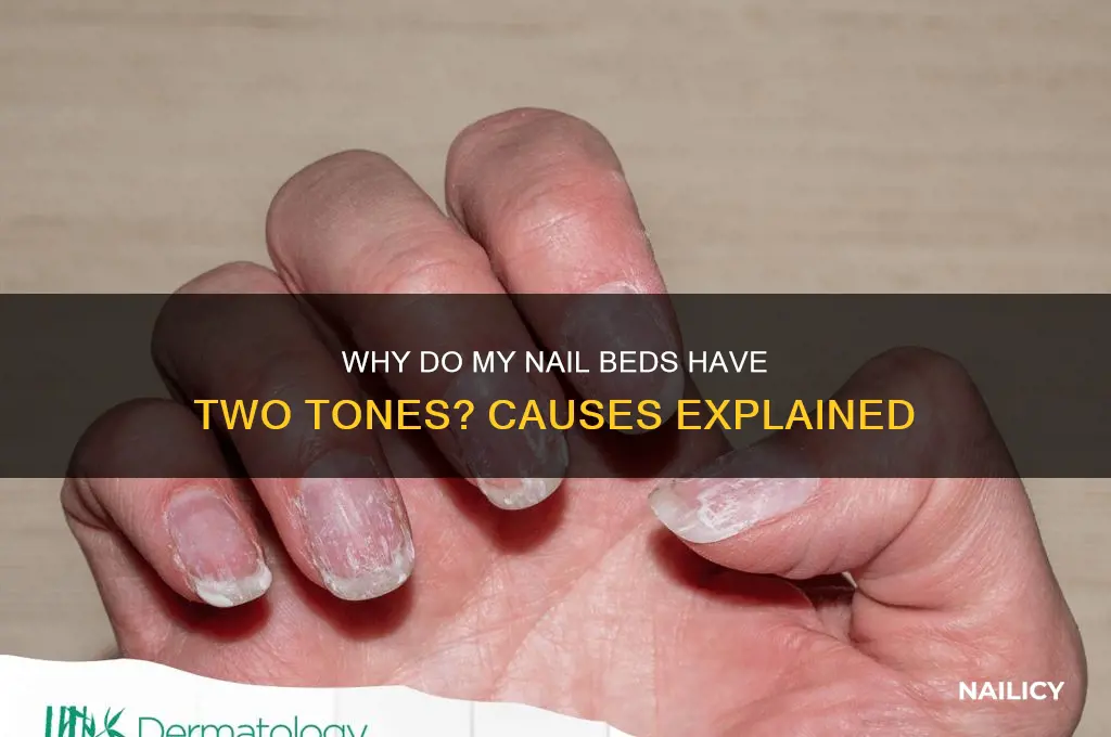 why do my nail beds have two tones
