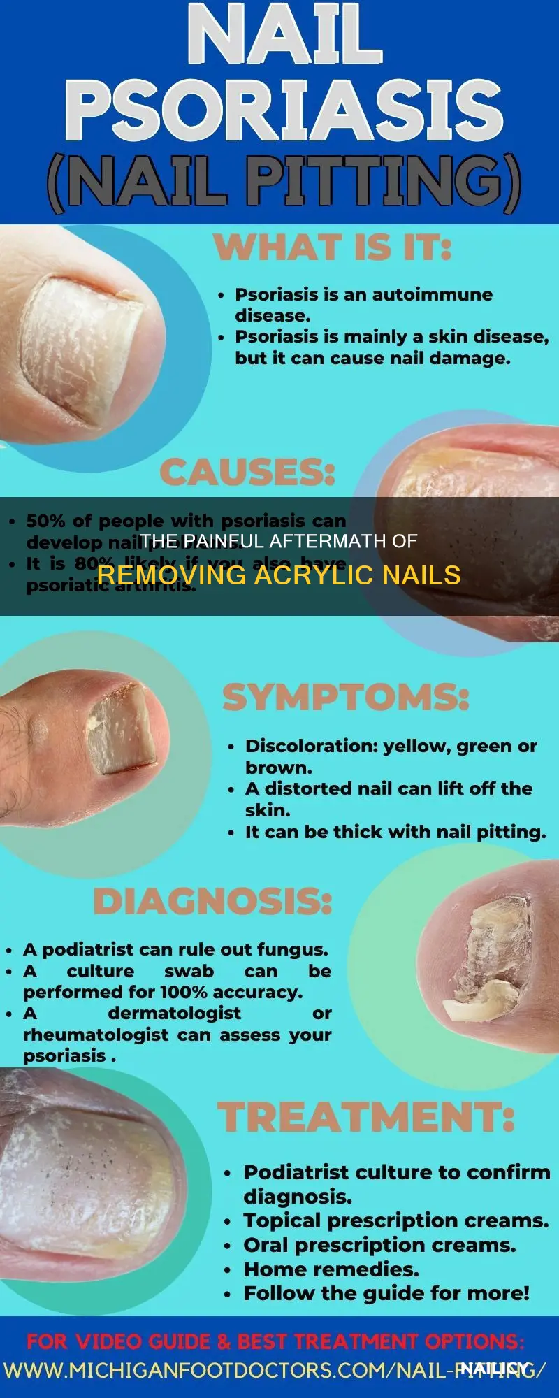why do my nail beds hurt after removing acrylics