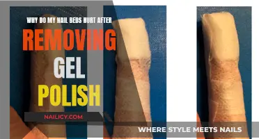 The Mystery of Sore Nail Beds After Gel Polish Removal