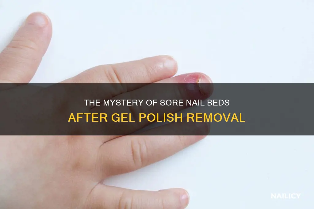 why do my nail beds hurt after removing gel polish