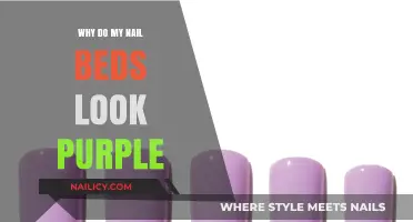 Why Are My Nail Beds Purple? Causes and Solutions Explained