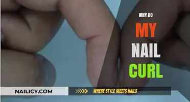 Why Do My Nails Curl? Causes, Prevention, and Solutions Explained