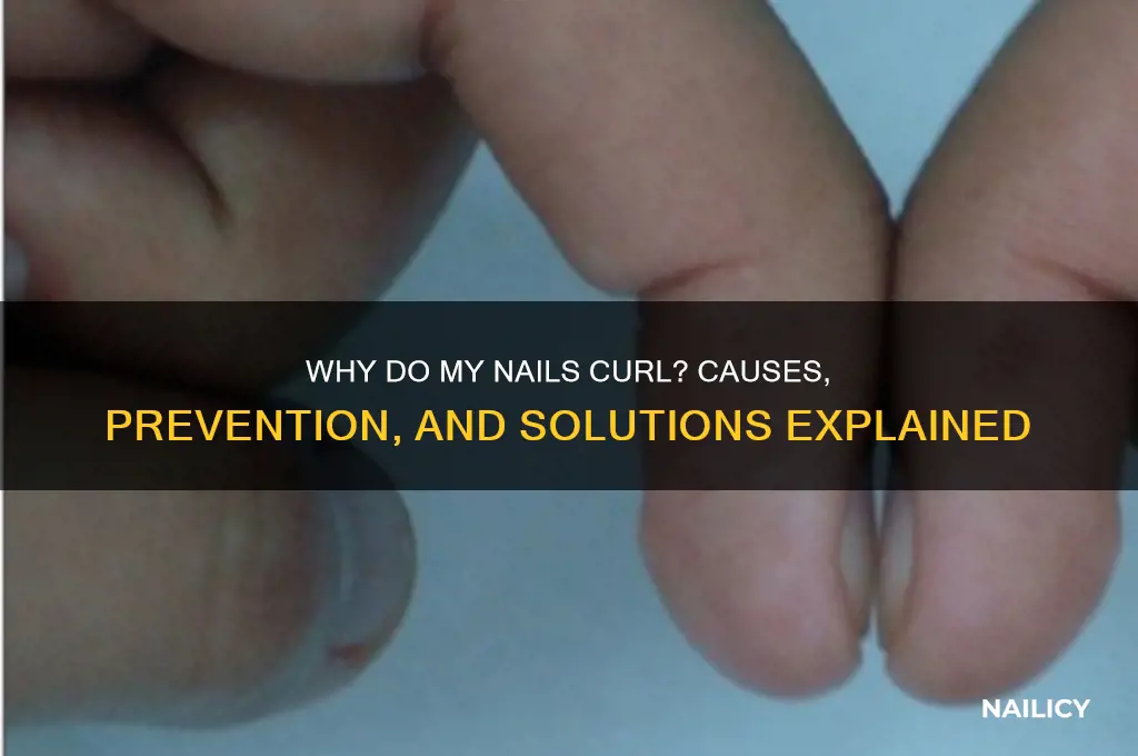 why do my nail curl