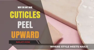 Why Do My Nail Cuticles Peel Upward? Causes and Solutions