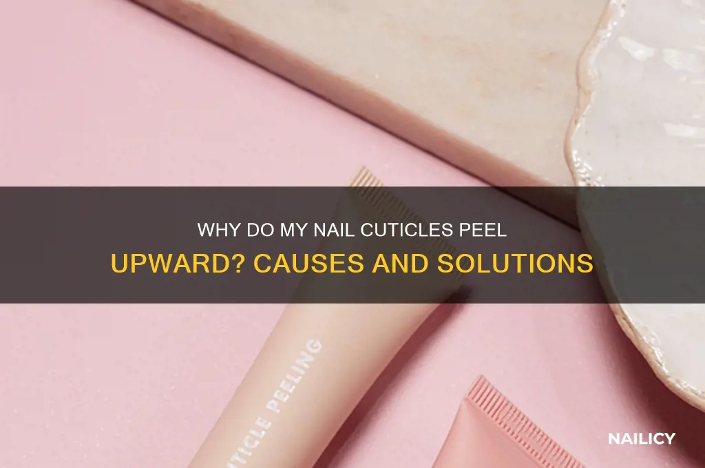 why do my nail cuticles peel upward