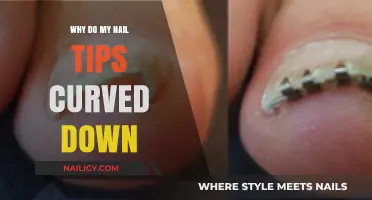Curved Nail Tips: Causes and Solutions for Downward Curving Nails