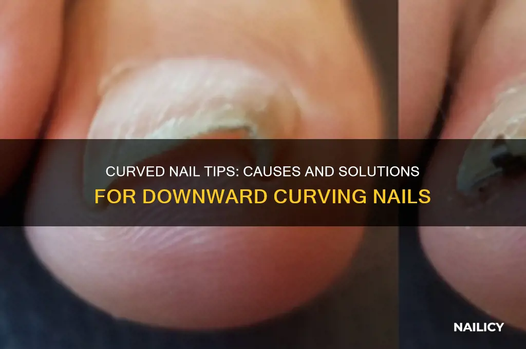 why do my nail tips curved down
