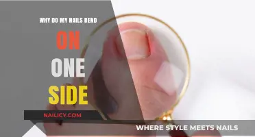 Why Do My Nails Bend on One Side? Causes and Solutions