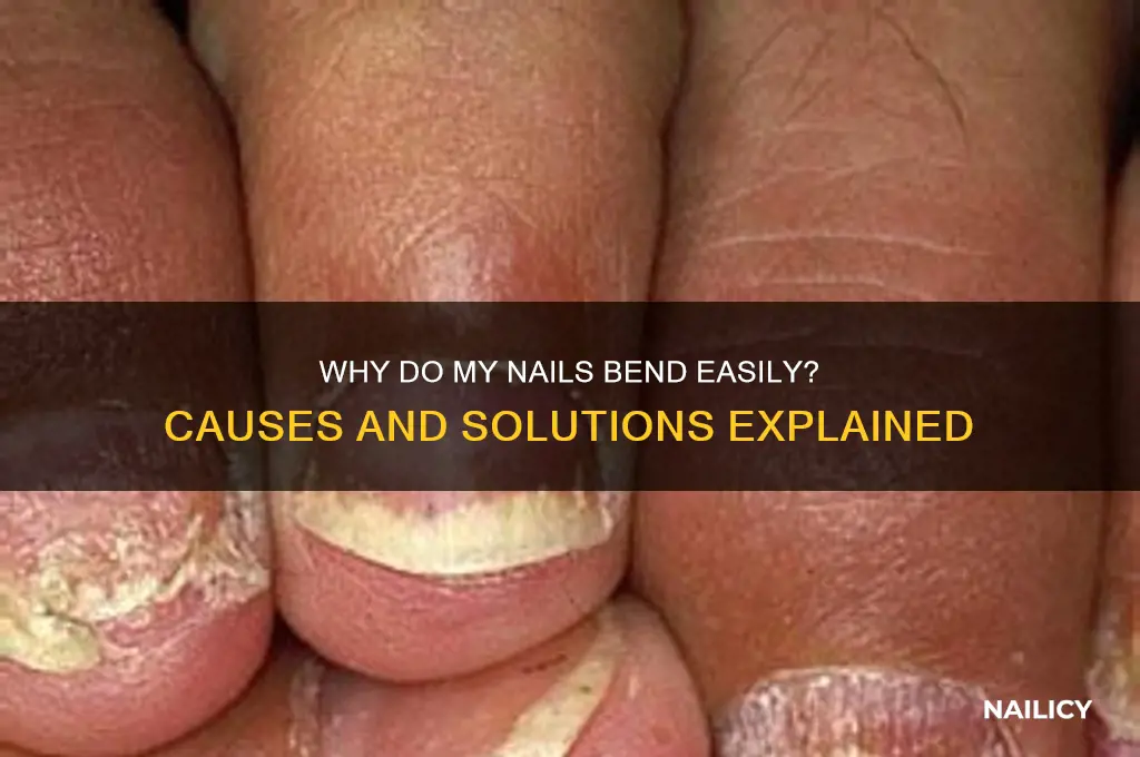 why do my nails bend so easily