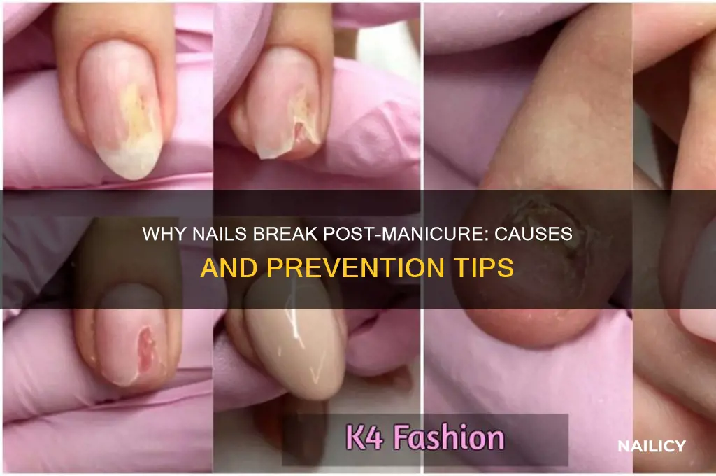 why do my nails break after a manicure