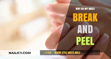 Why Do My Nails Break and Peel? Causes and Solutions