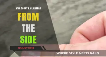 Why Do My Nails Break from the Side? Causes and Solutions