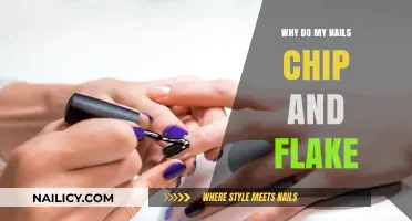 Why Do My Nails Chip and Flake? Causes and Solutions