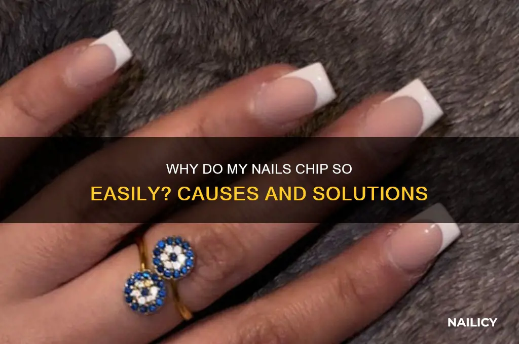 why do my nails chip so easily