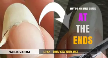 Why Do My Nails Crack at the Ends? Causes and Solutions