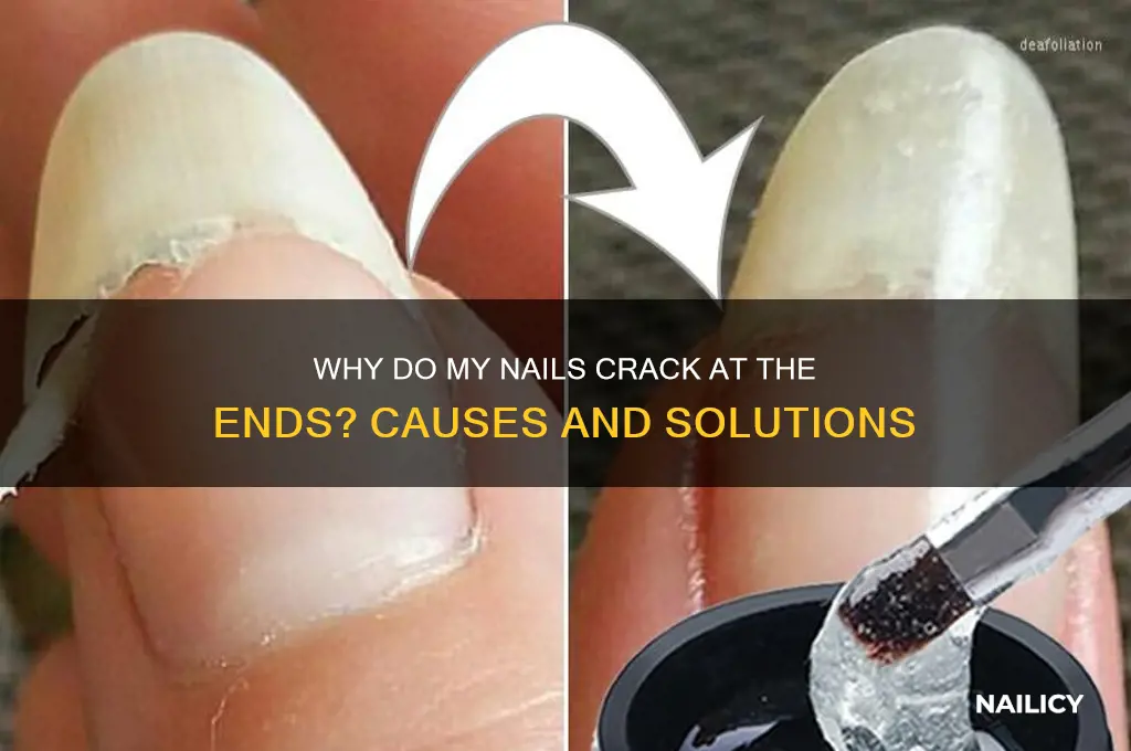 why do my nails crack at the ends