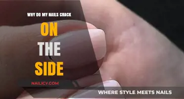 Why Do My Nails Crack on the Side? Causes and Solutions