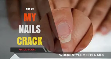 Why Do My Nails Crack? Causes and Solutions for Brittle Nails